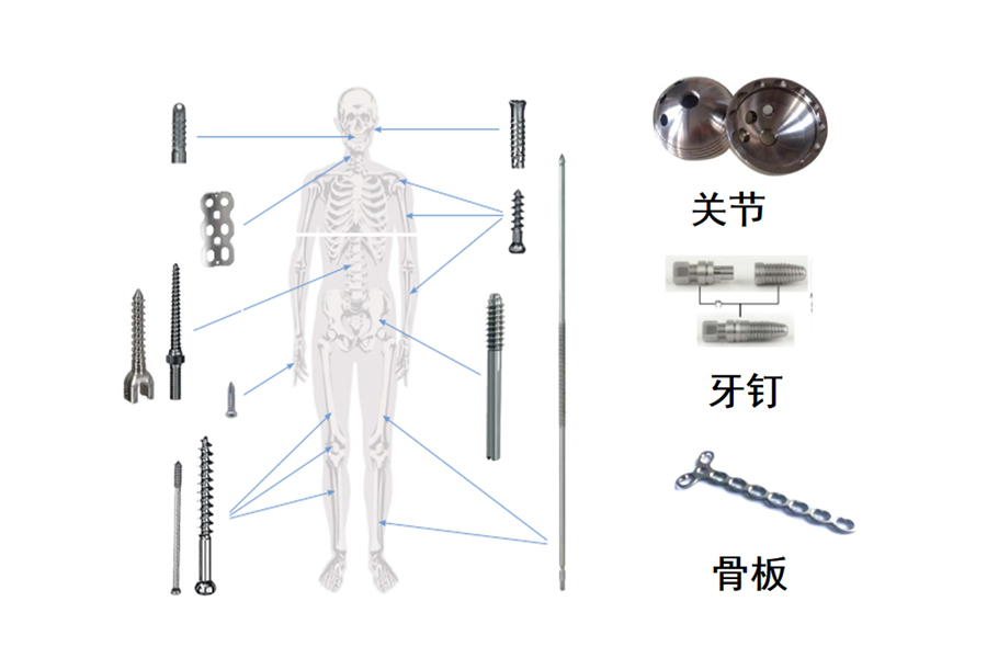 醫(yī)療骨科、牙釘、脊椎